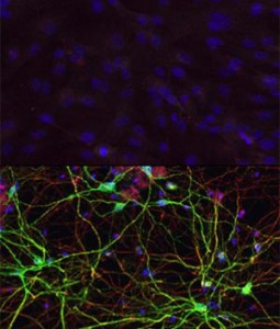 Human skin cells (top) can be transformed into medium spiny neurons (bottom) with subjection to the perfect combination of microRNAs and transcription elements, with respect to work by Andrew Yoo and co-workers. IMAGE CREDIT: Yoo Lab