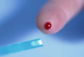 Evaluating blood sugar levels of acute heart failure sufferers might be a easy and affordable way to figure out sufferers at great risk of early death, additional hospitalizations or the development of diabetes.