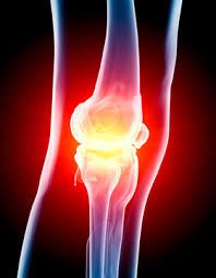 Investigators hope that their new stem cell process will one day be applied to cure degenerative disease osteoarthritis.