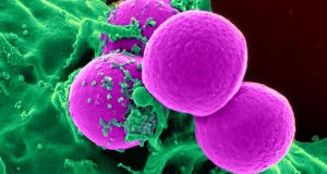 The investigators discovered that the new investigational drug killed MRSA bacteria in such a way not found before in presently used antibiotics.
