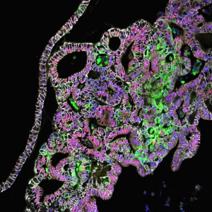 Image Shows Tissue-Engineered Human Stomach, Image credit: Cincinnati Children's Hospital